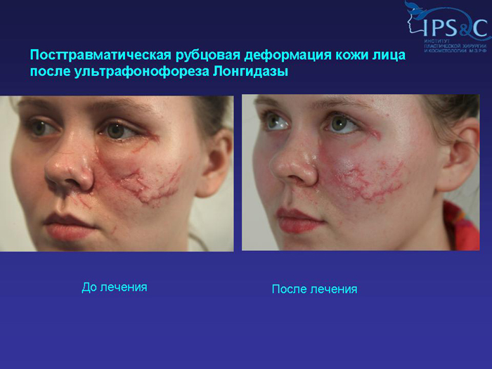 RraTA-raч-ocmeTologaga #arklynyk, rahyowskoй natalyk 